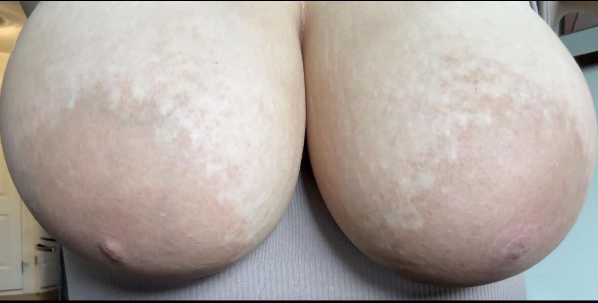 巨大な乳輪。