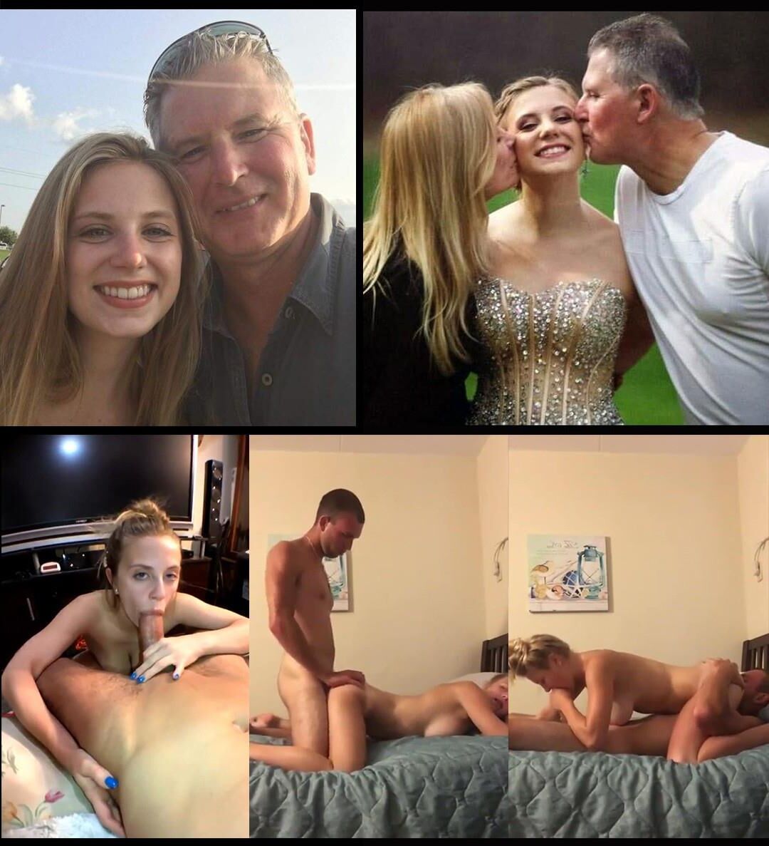 Antes e depois