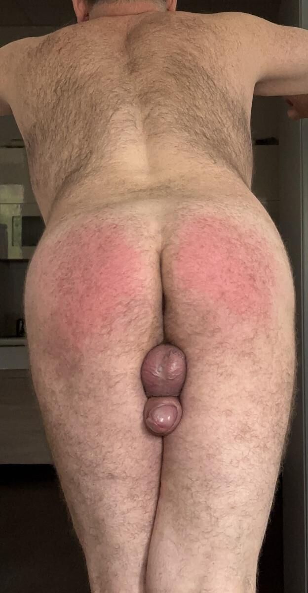 Mi azotes FAP