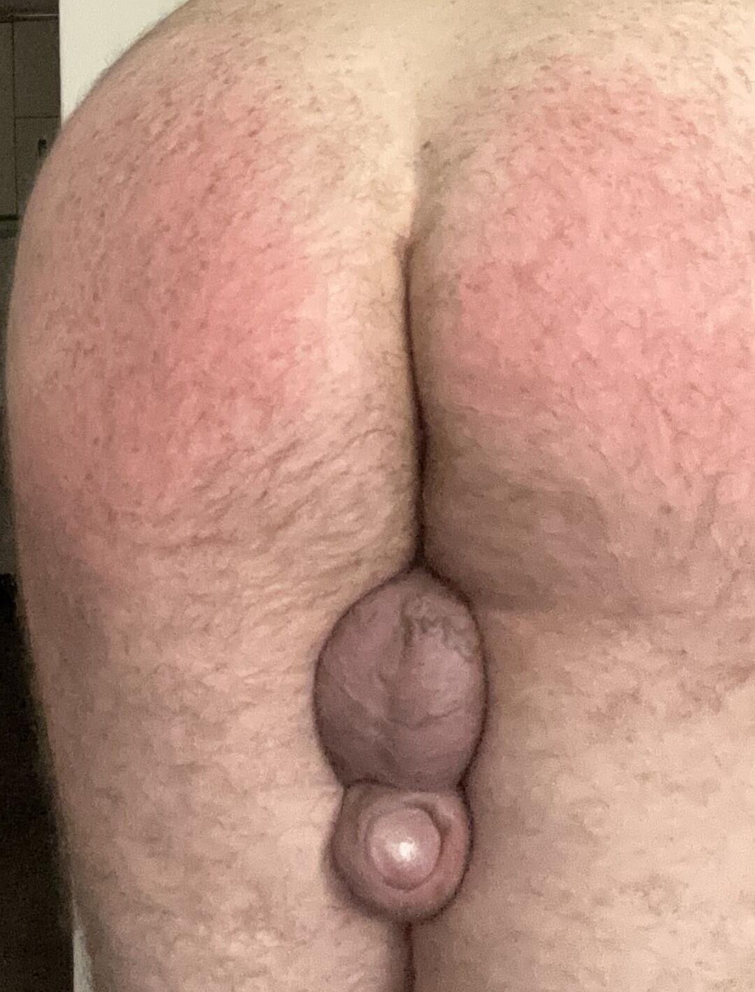 Mi azotes FAP