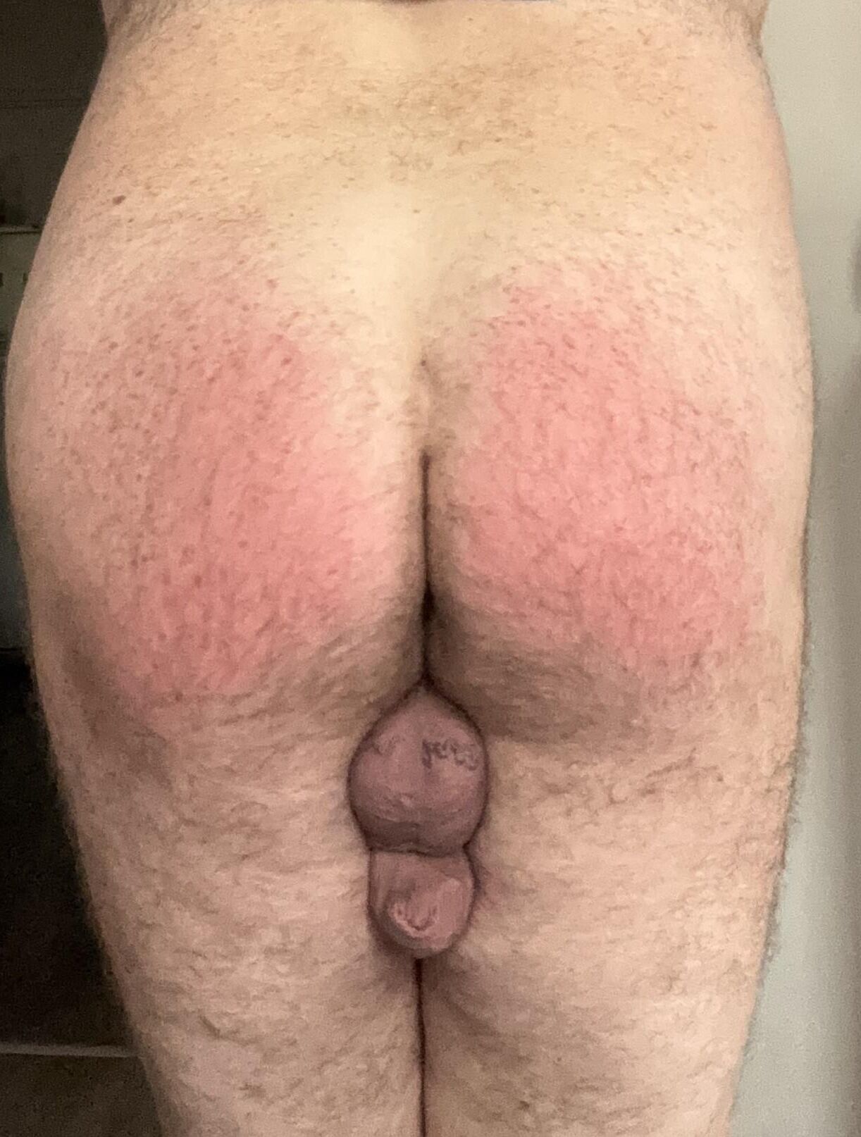 Mi azotes FAP