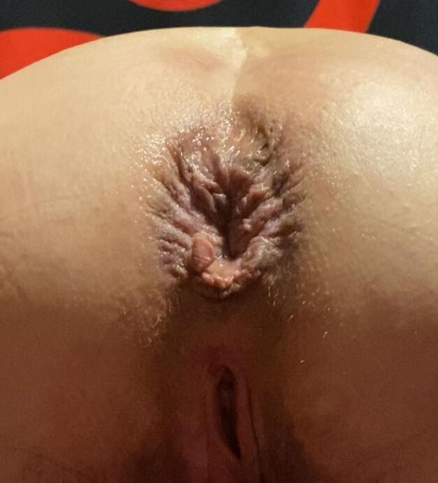 お尻と肛門