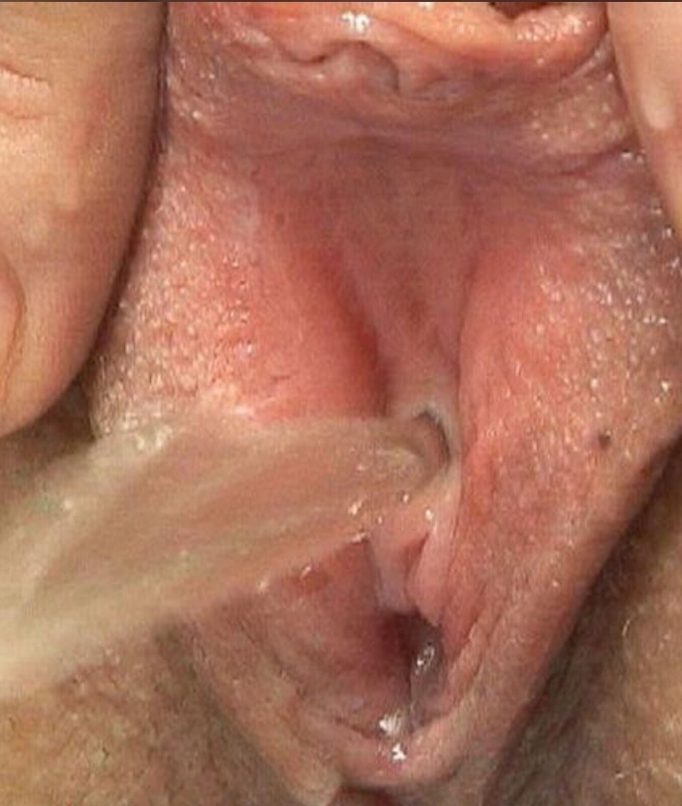 Mezcla de orina