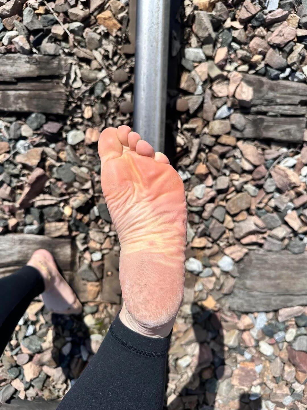 Hot Feet and Soles 