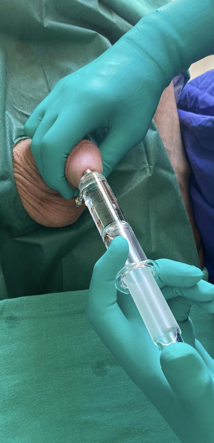 Prep for Medical Procedure
