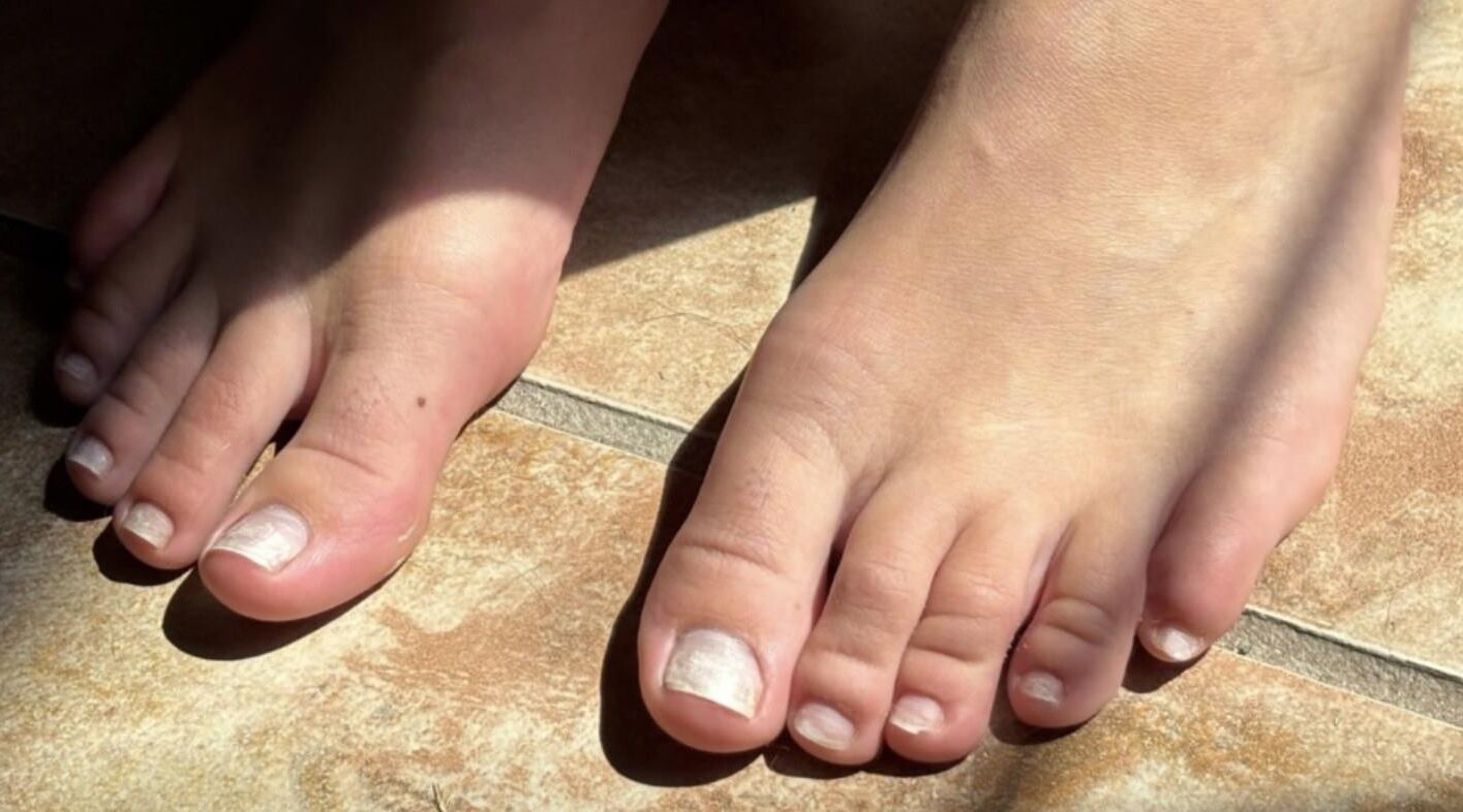 Kristins sexy natural, no polish toes up close 