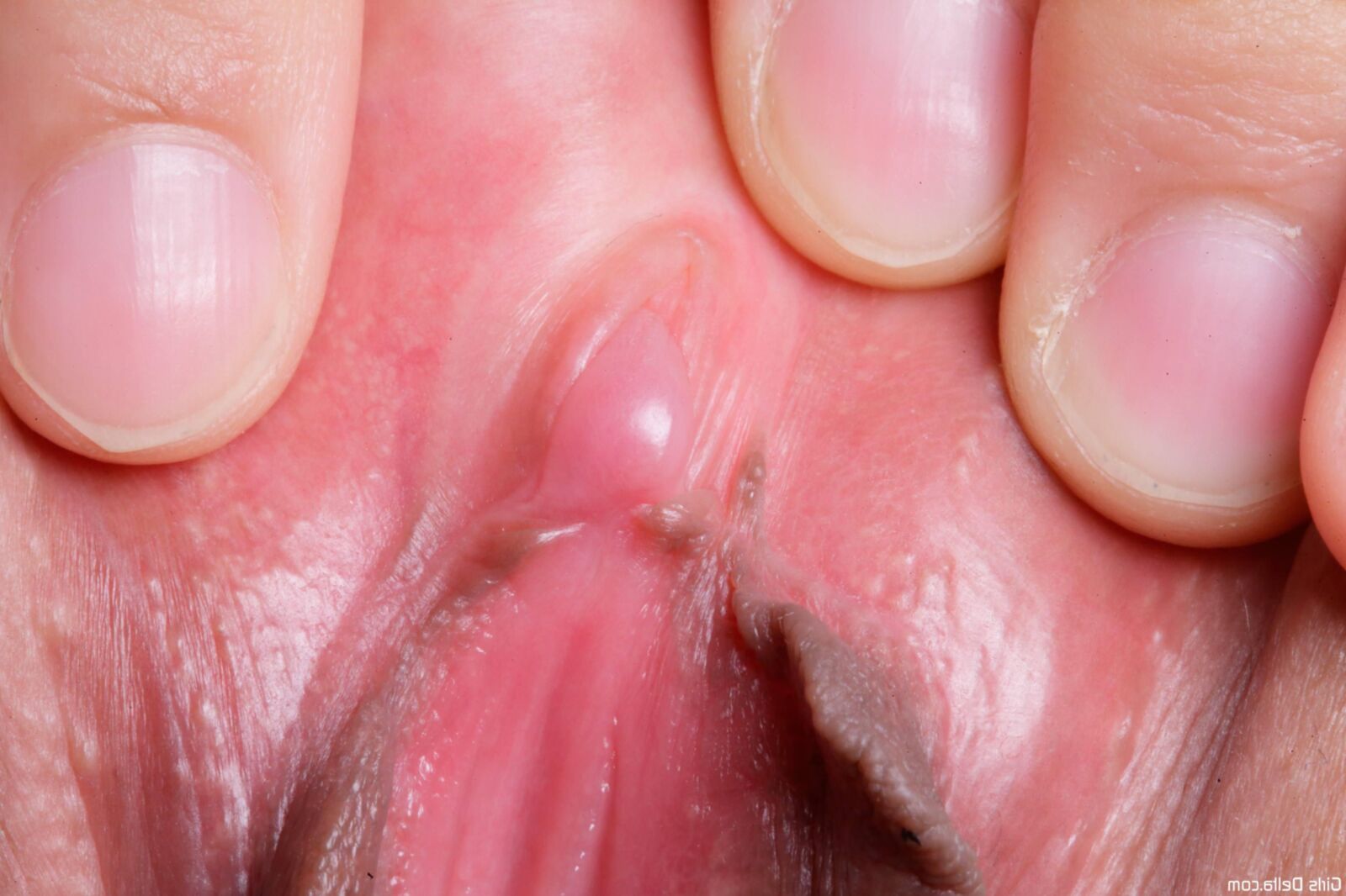 Clit Closeups 