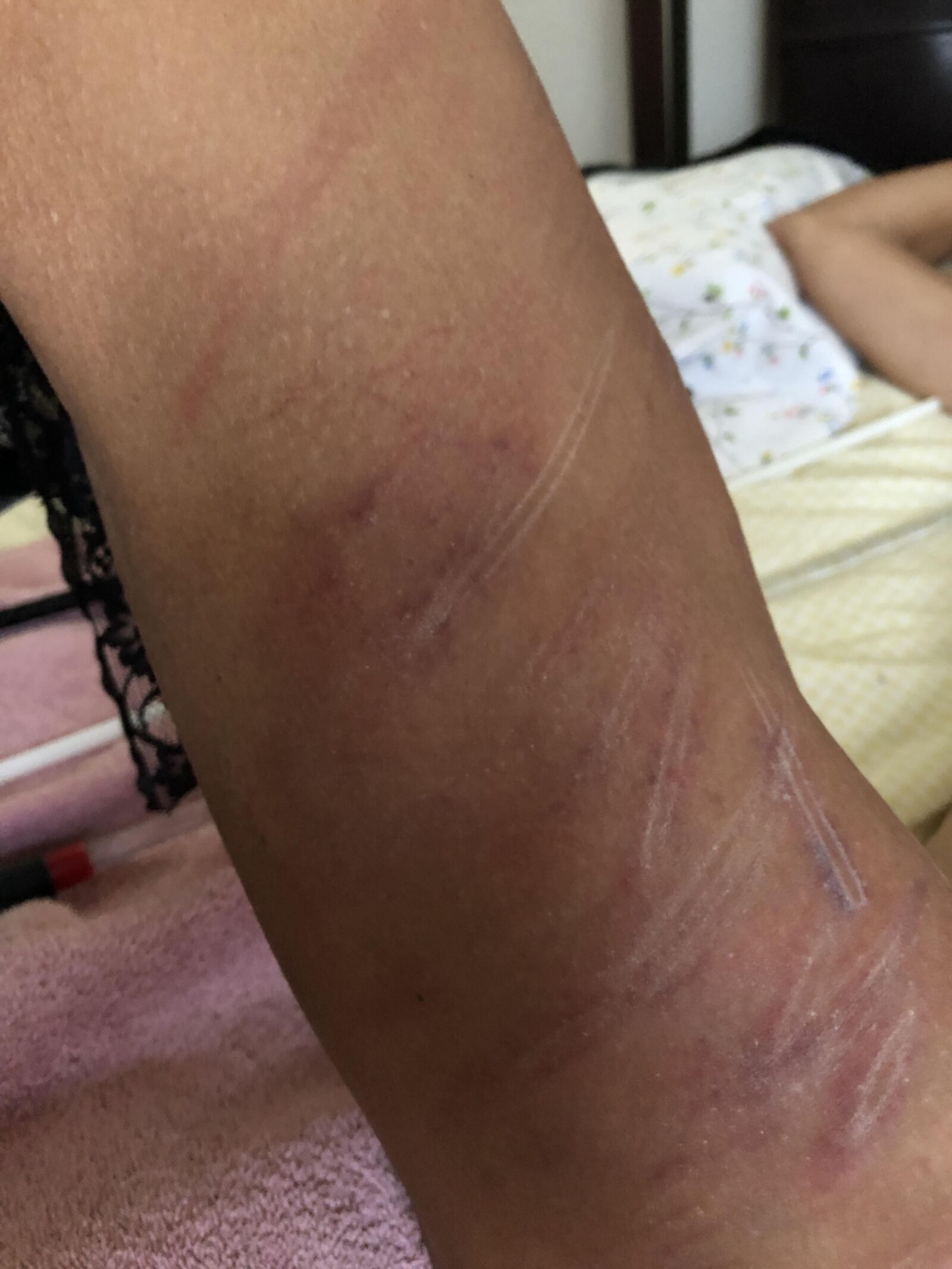 BDSMおばあちゃんの売春婦スキニー拒食症