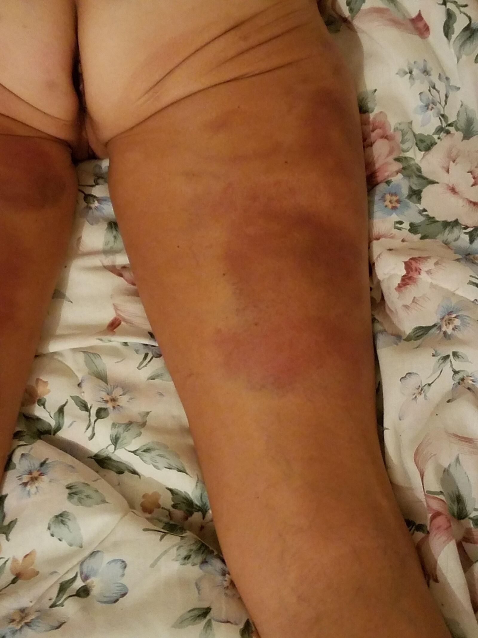 BDSMおばあちゃんの売春婦スキニー拒食症
