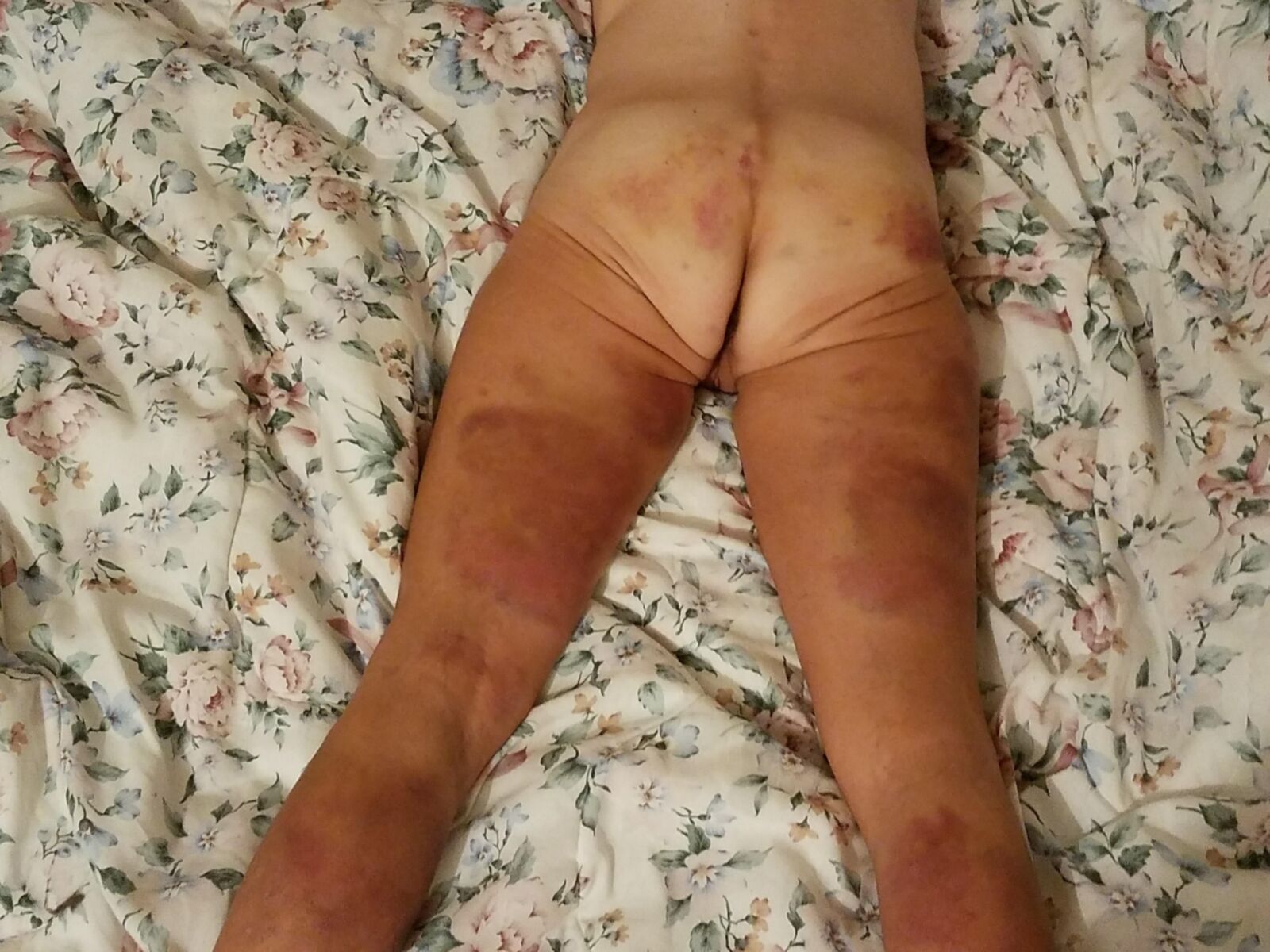 BDSMおばあちゃんの売春婦スキニー拒食症