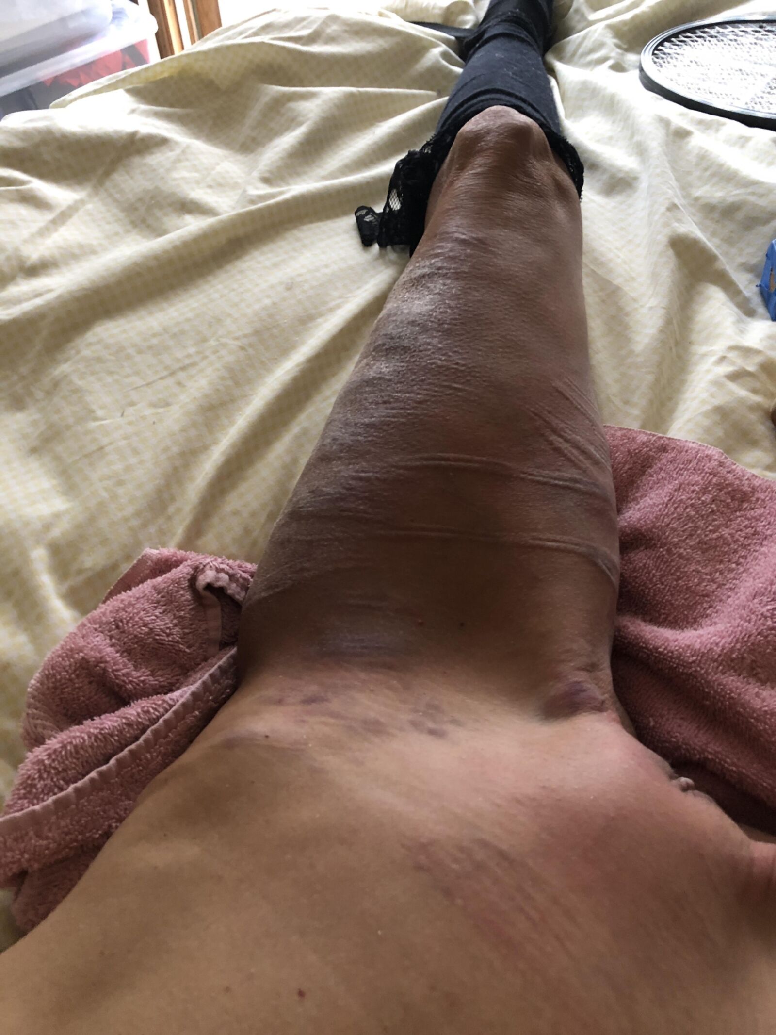 BDSMおばあちゃんの売春婦スキニー拒食症