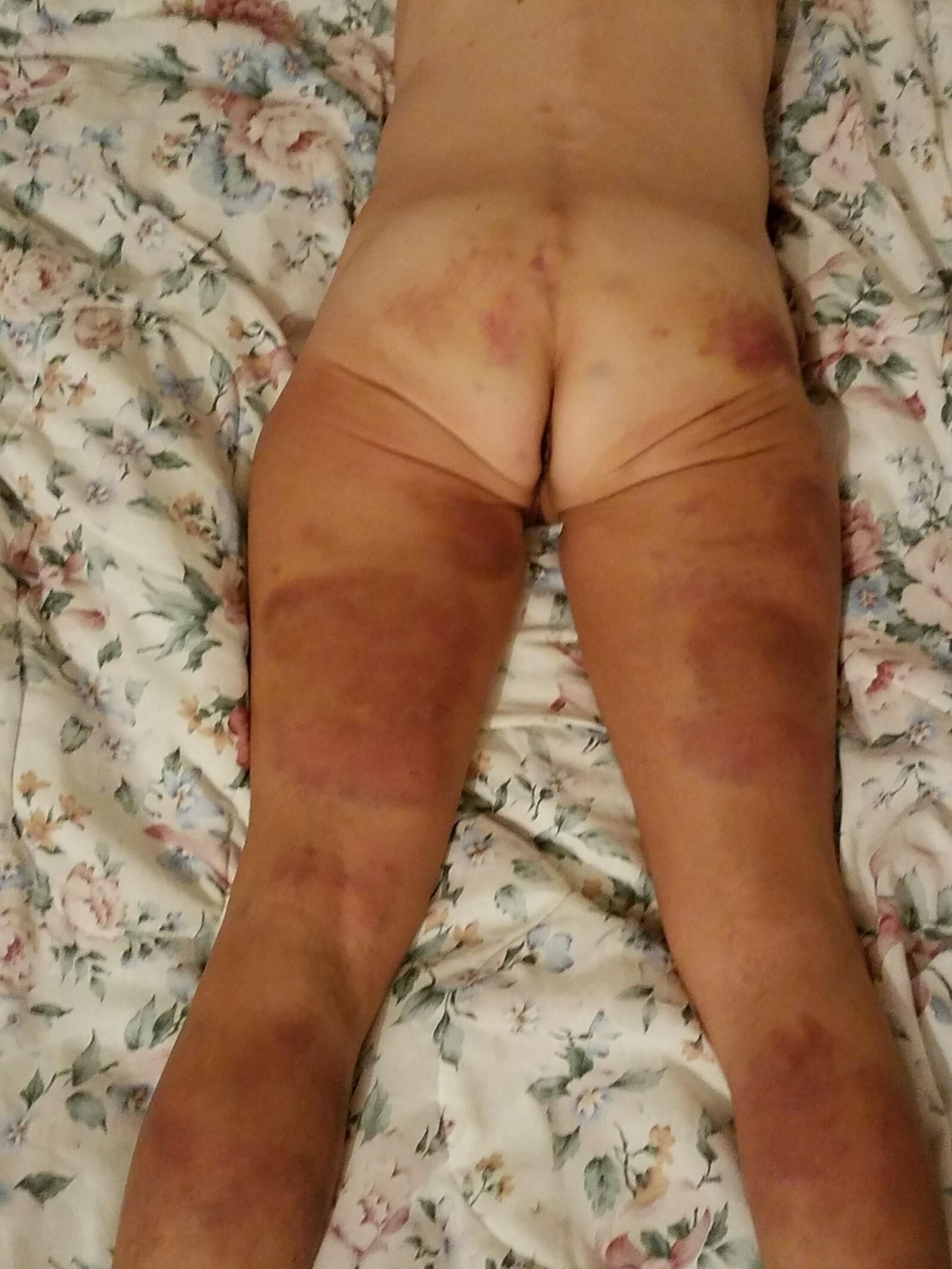 BDSMおばあちゃんの売春婦スキニー拒食症