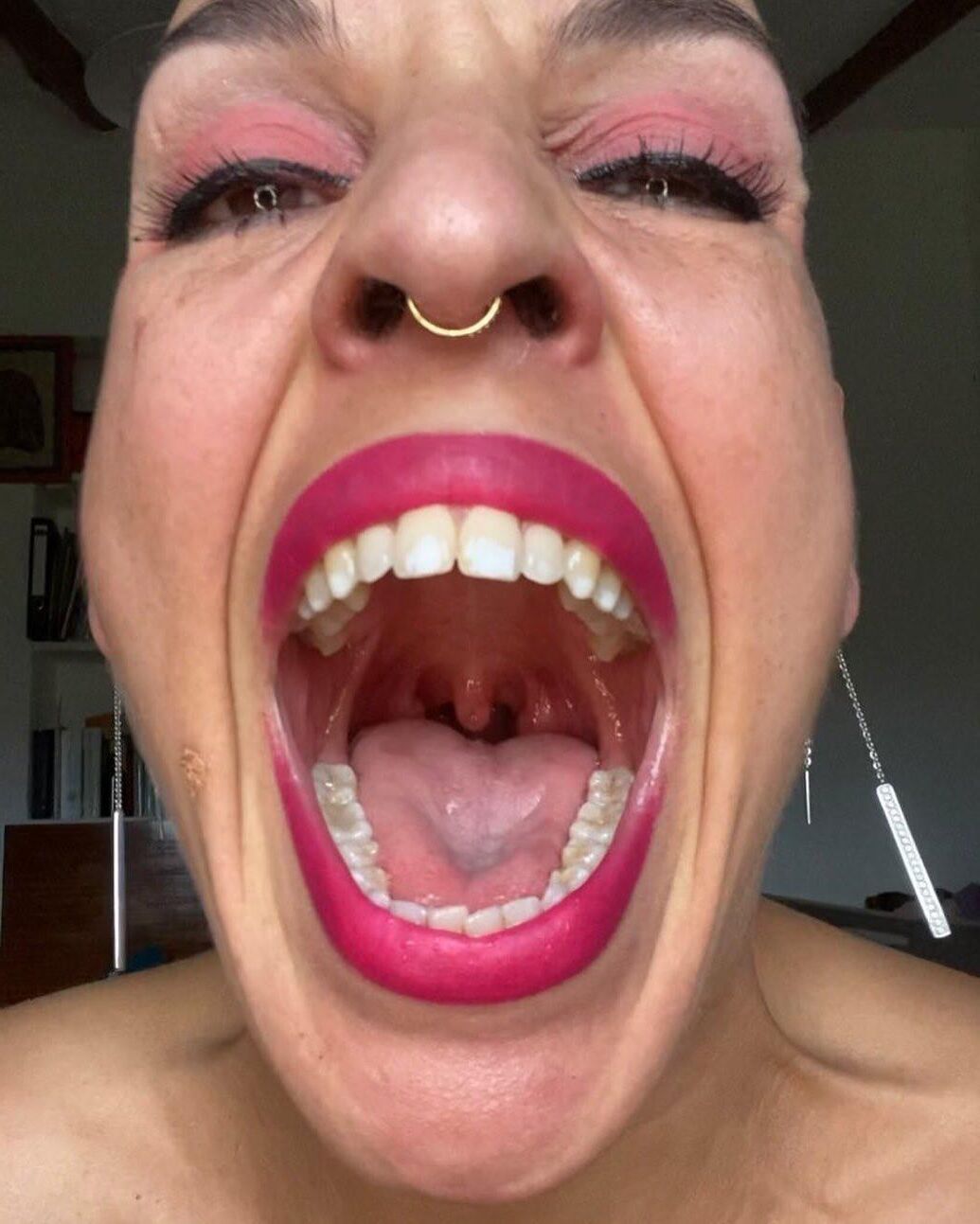 Tongues and tonsils 