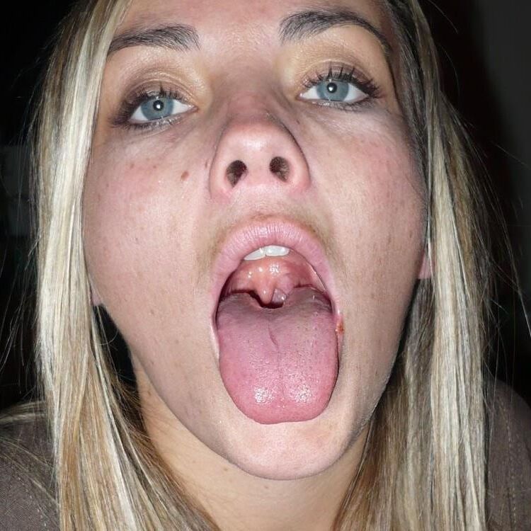 Tongues and tonsils 
