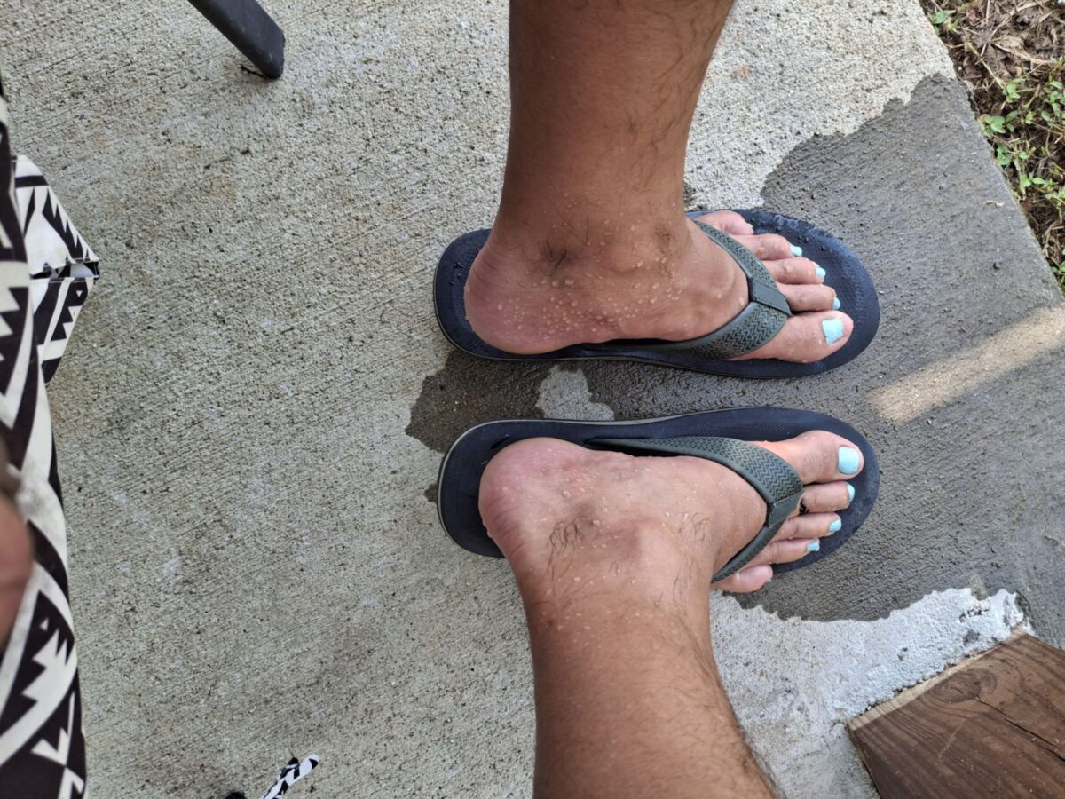 Mit Flip Flops auf meine Füße pissen