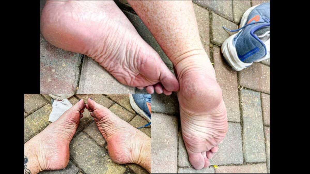 Ses pieds de gingembre