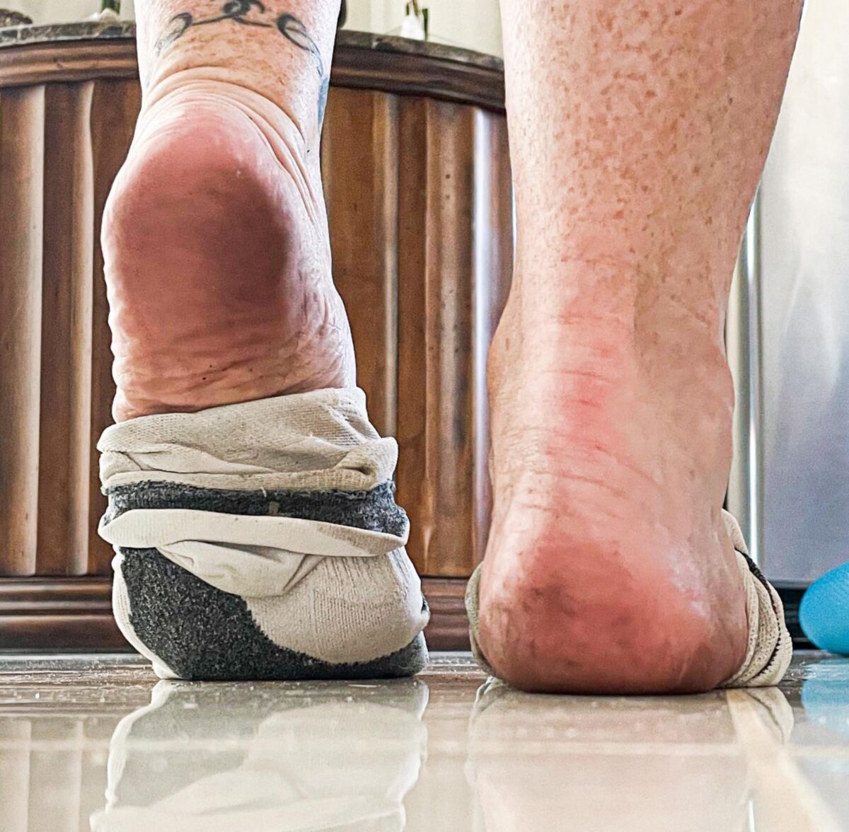 Ses pieds de gingembre