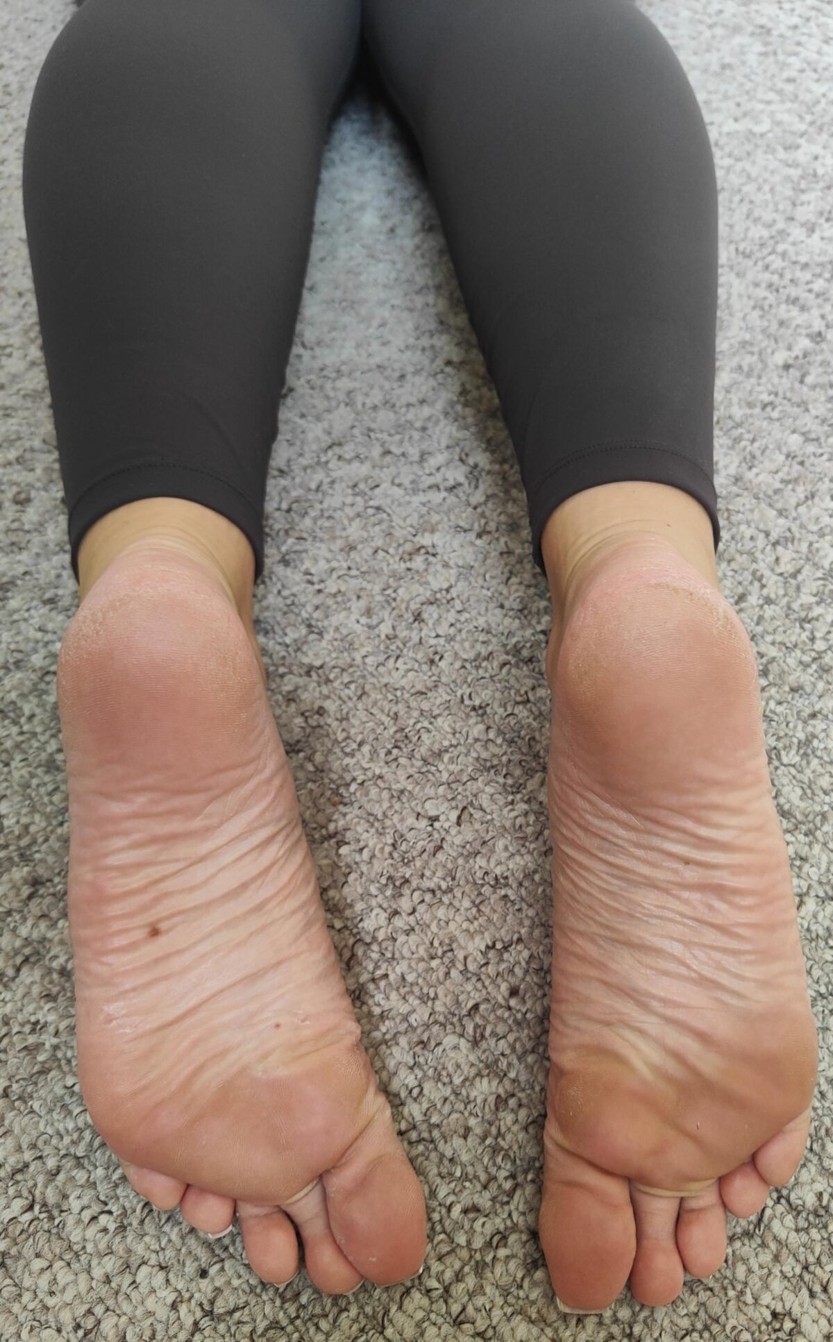 Mes pieds (après le gymnase)