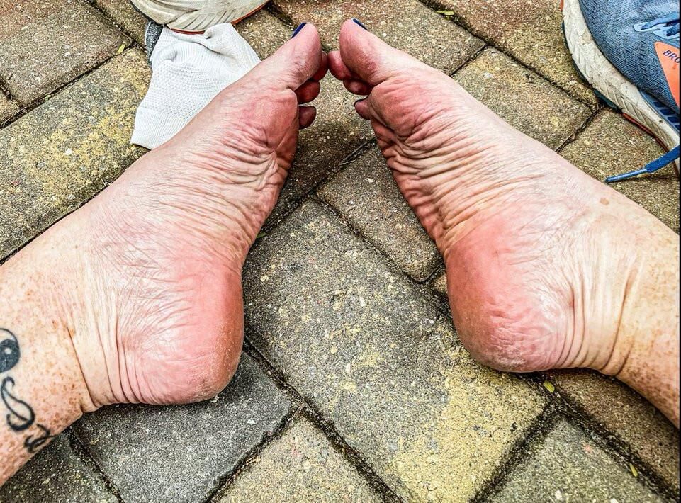 Ses pieds de gingembre