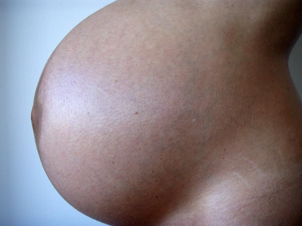 Beautiful Bumps of The Week ..