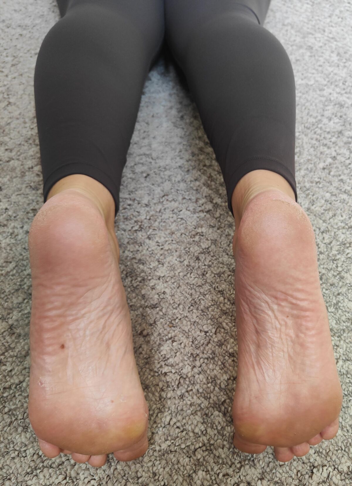Mes pieds (après le gymnase)