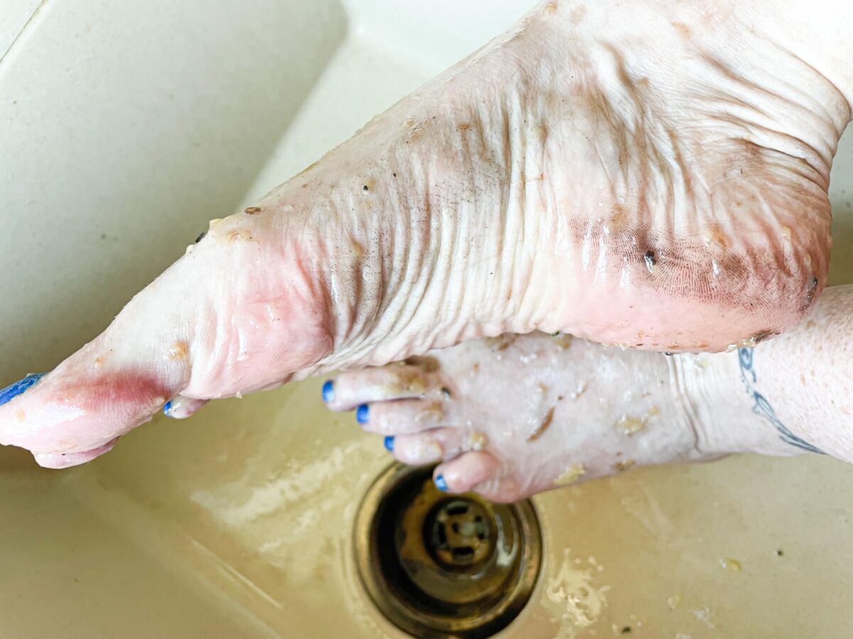 Ses pieds de gingembre