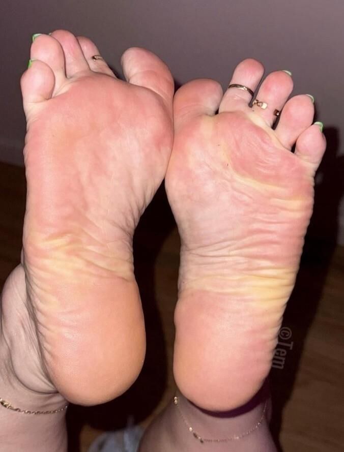 Hot Feet and Soles 