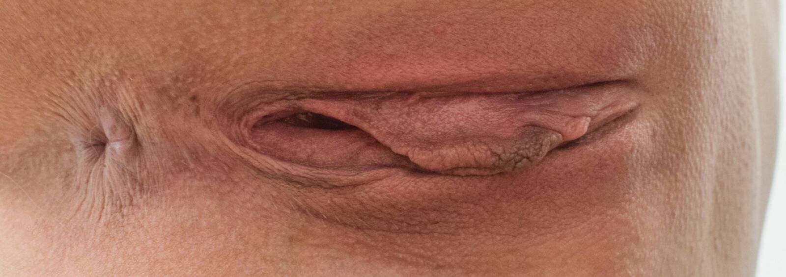ânus