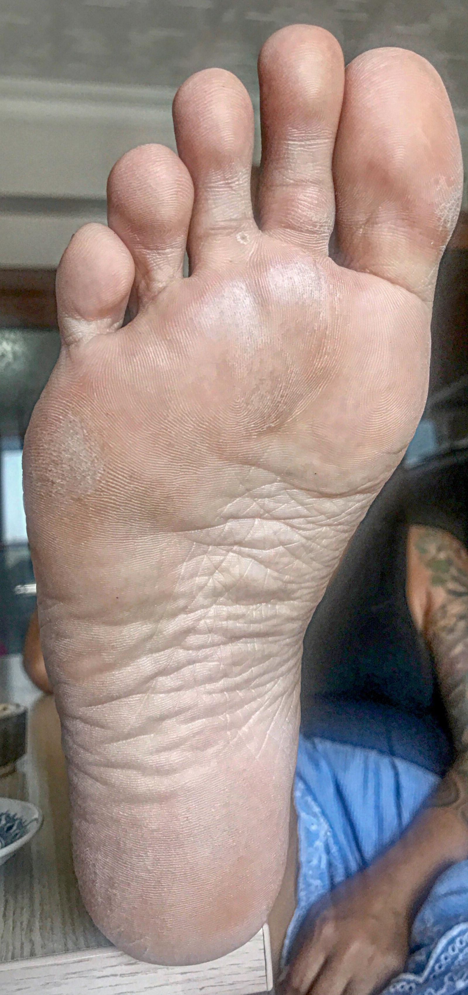 Pieds et semelles