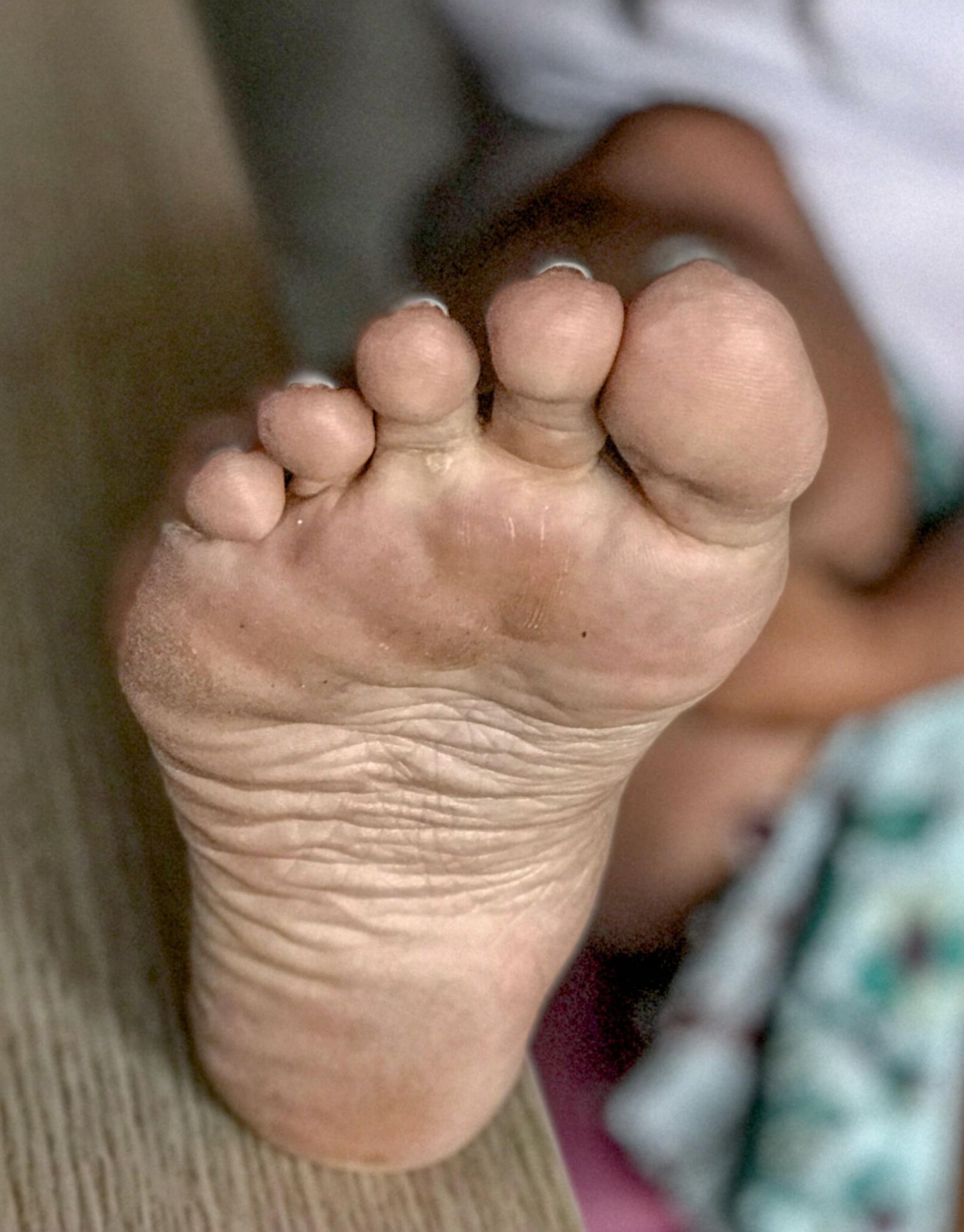 Pieds et semelles