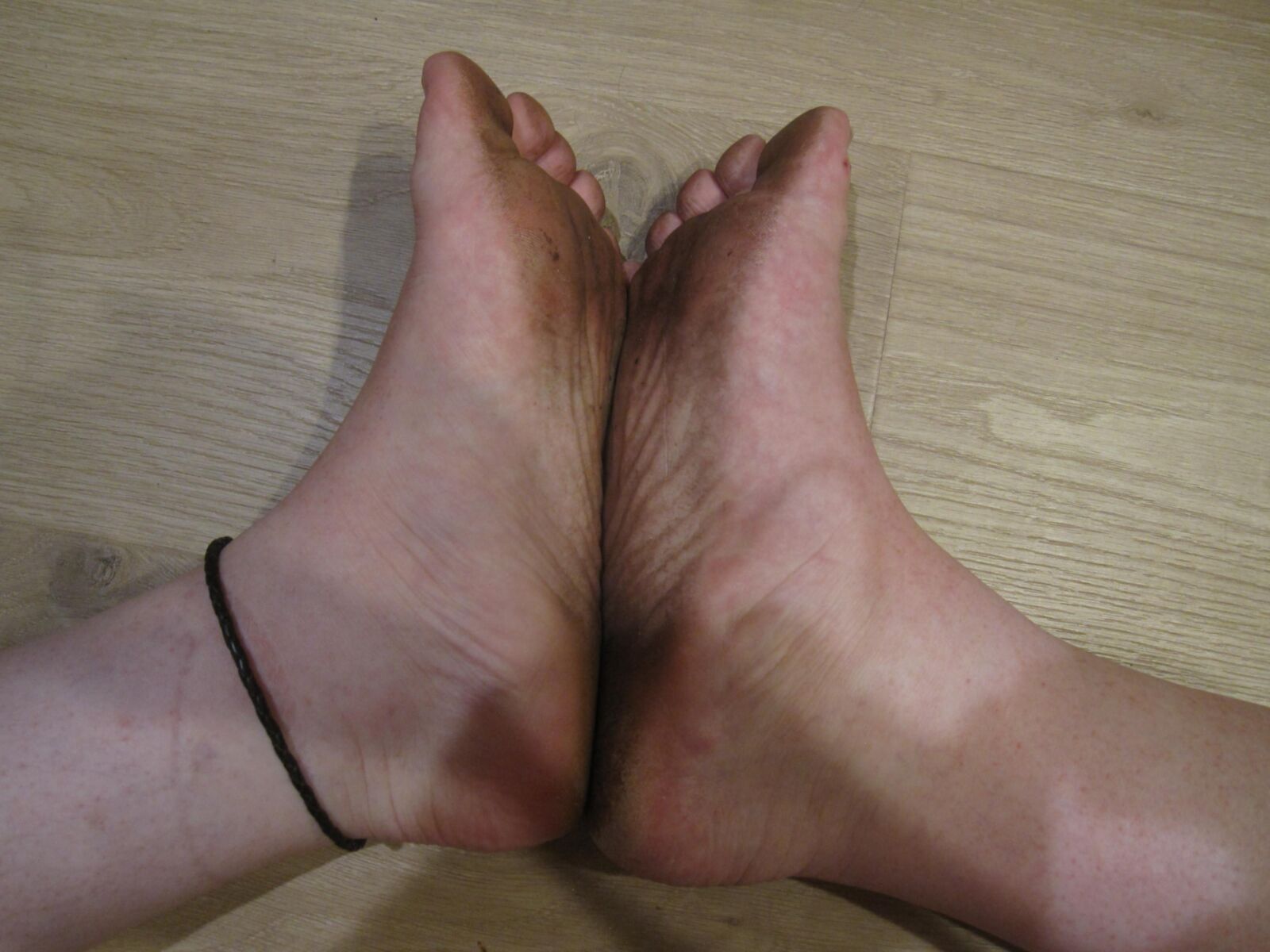 私の汚い足