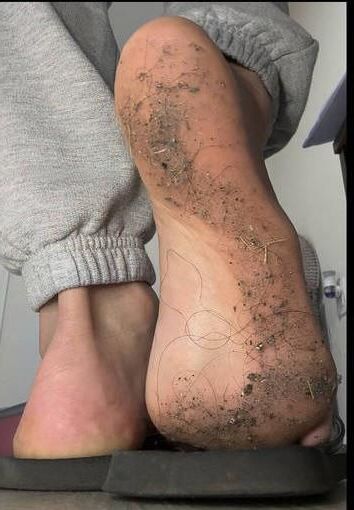 fetish 