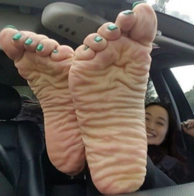 Hot Feet and Soles 