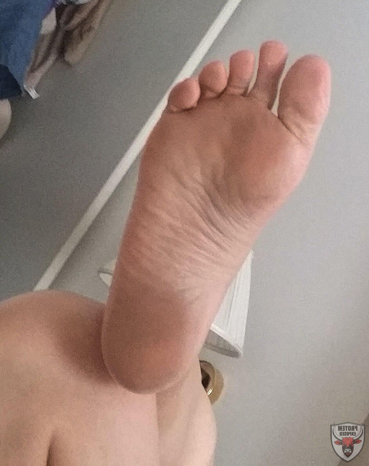 Hot Feet and Soles 