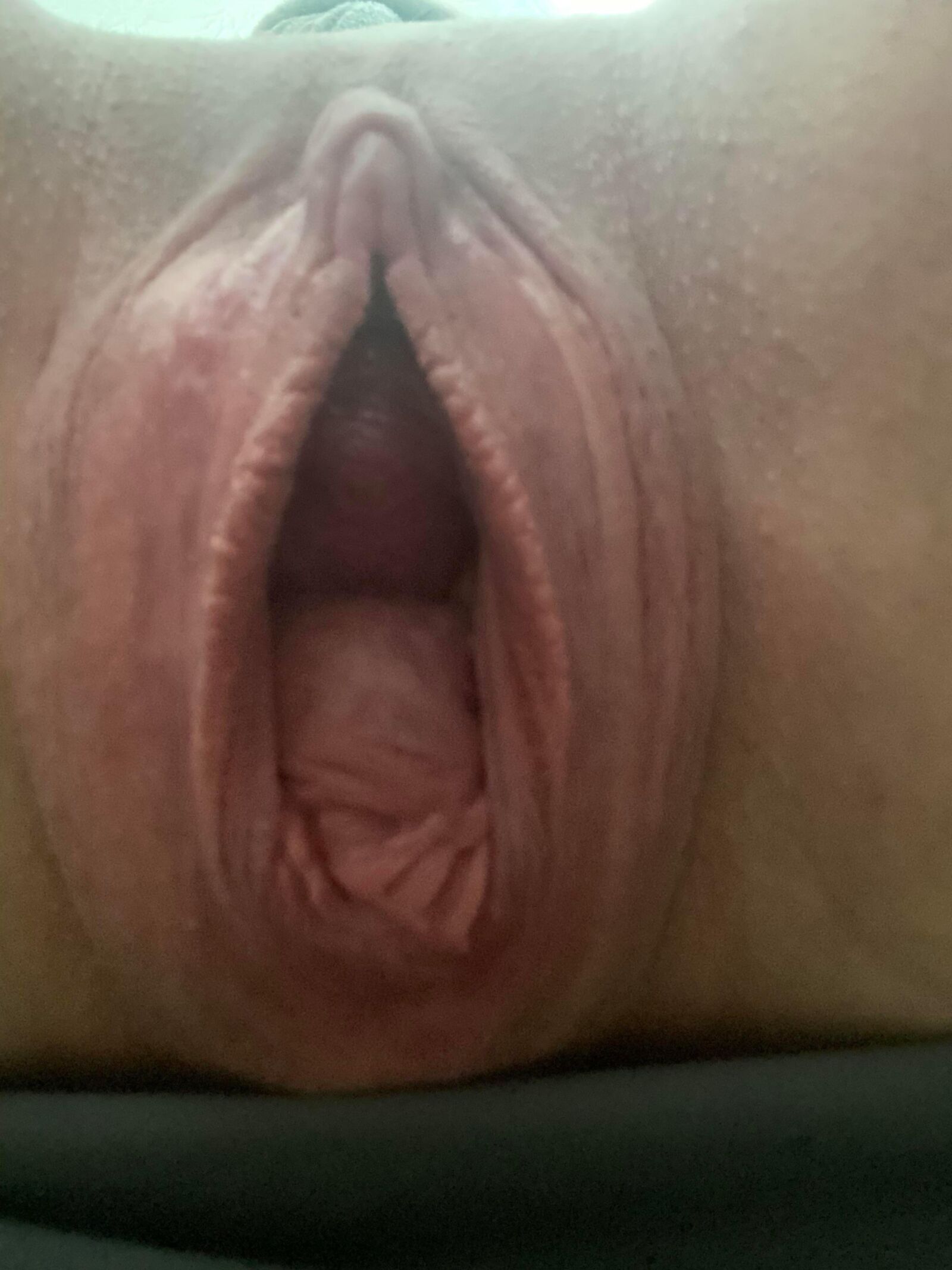 perma gape: permanently open pussy 