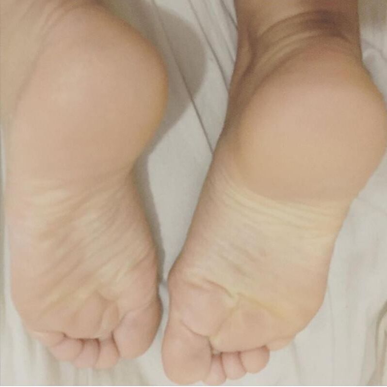 熱い足と裏
