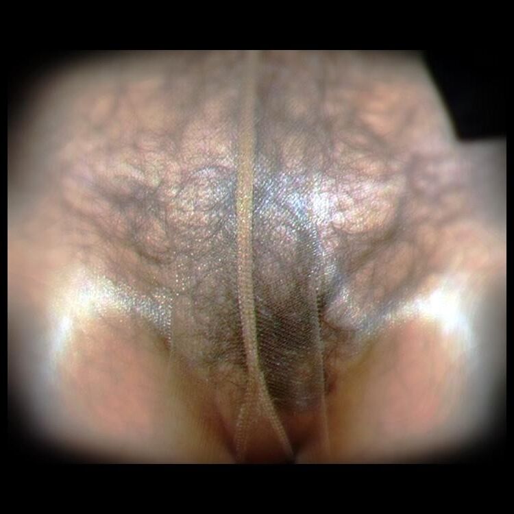 Frauen Vagina 