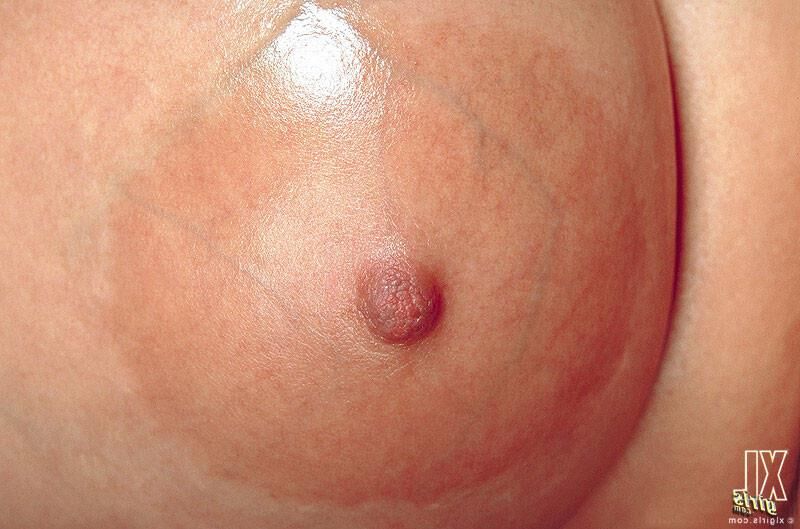 Areolas of Note...Stunning