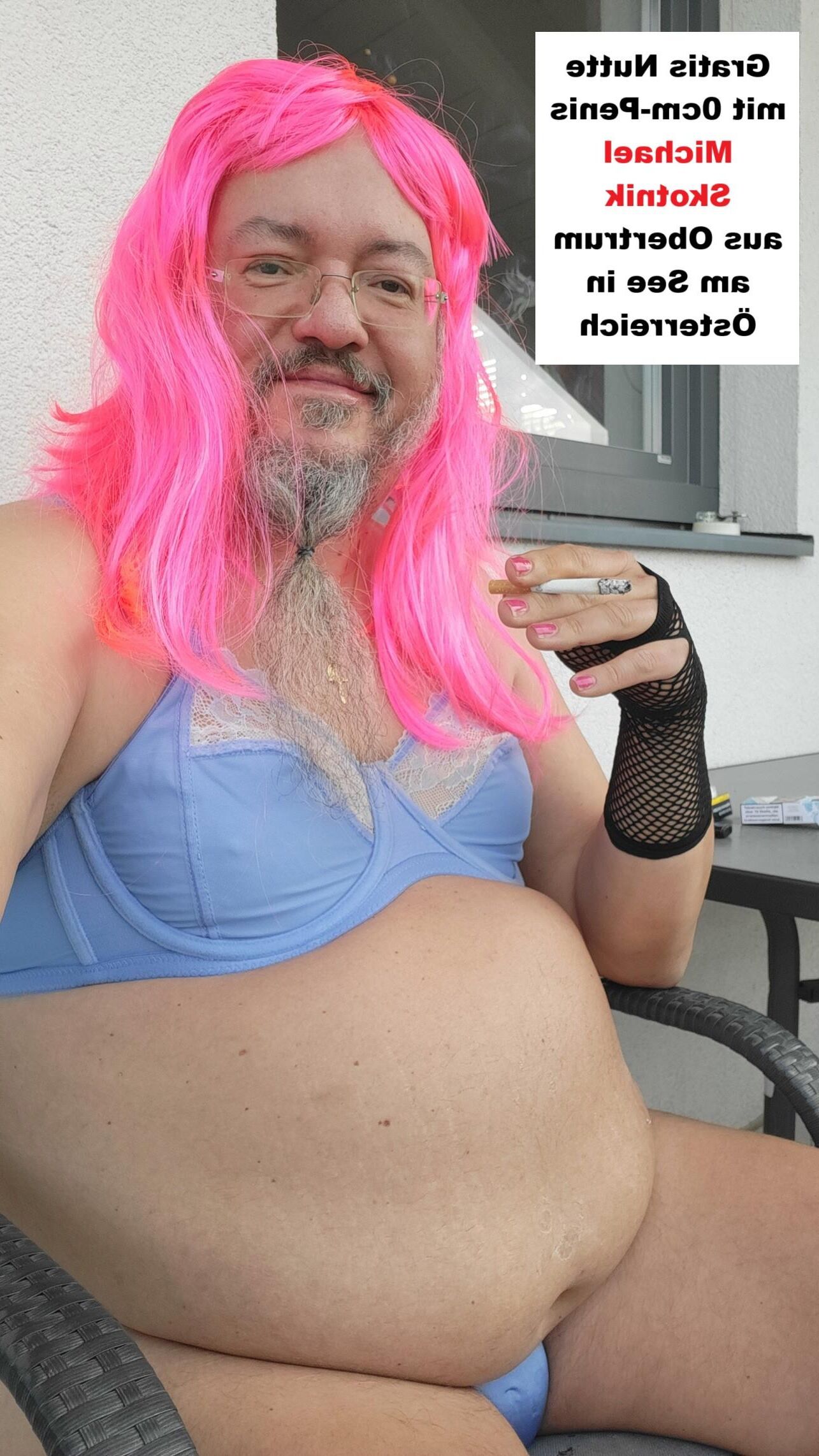 Mikropenis Michael Skotnik