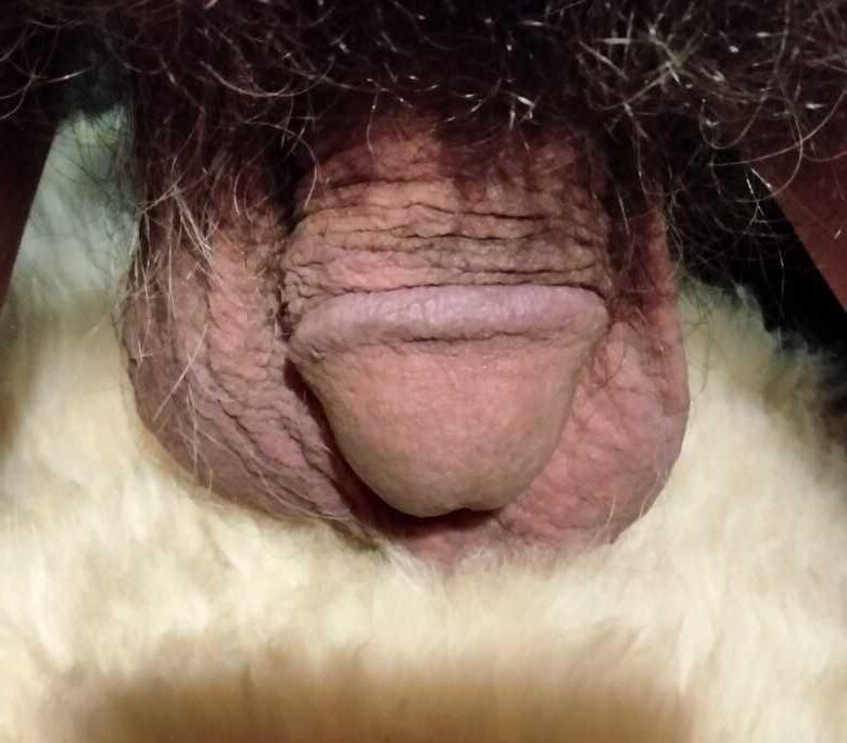 Pequeño pene