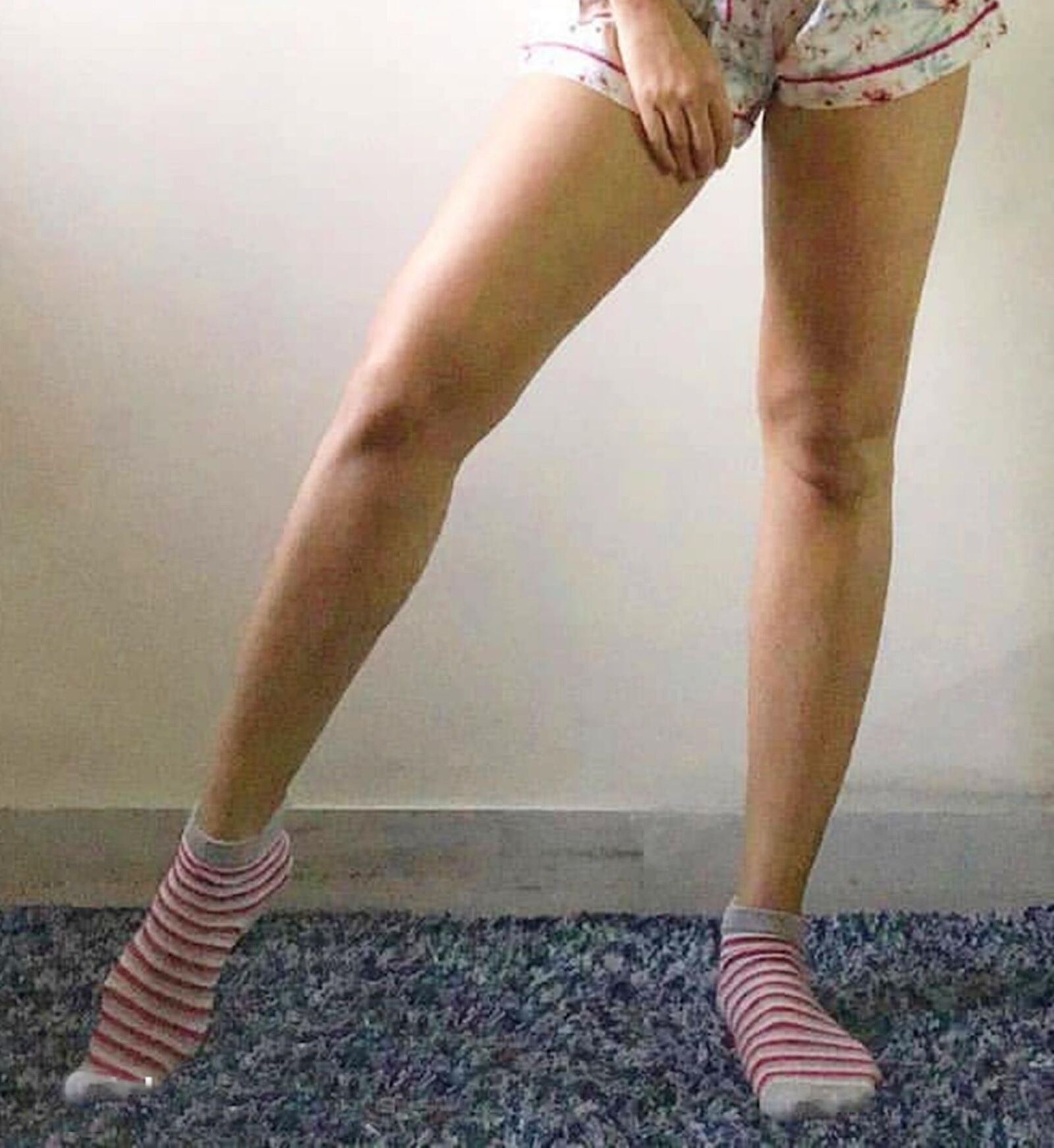 Legs for days