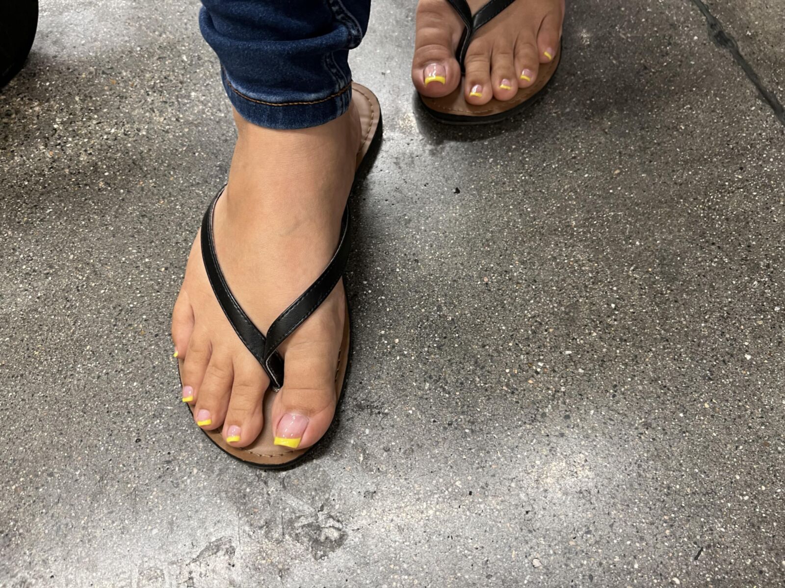 黄色のフレンチチップペディキュア