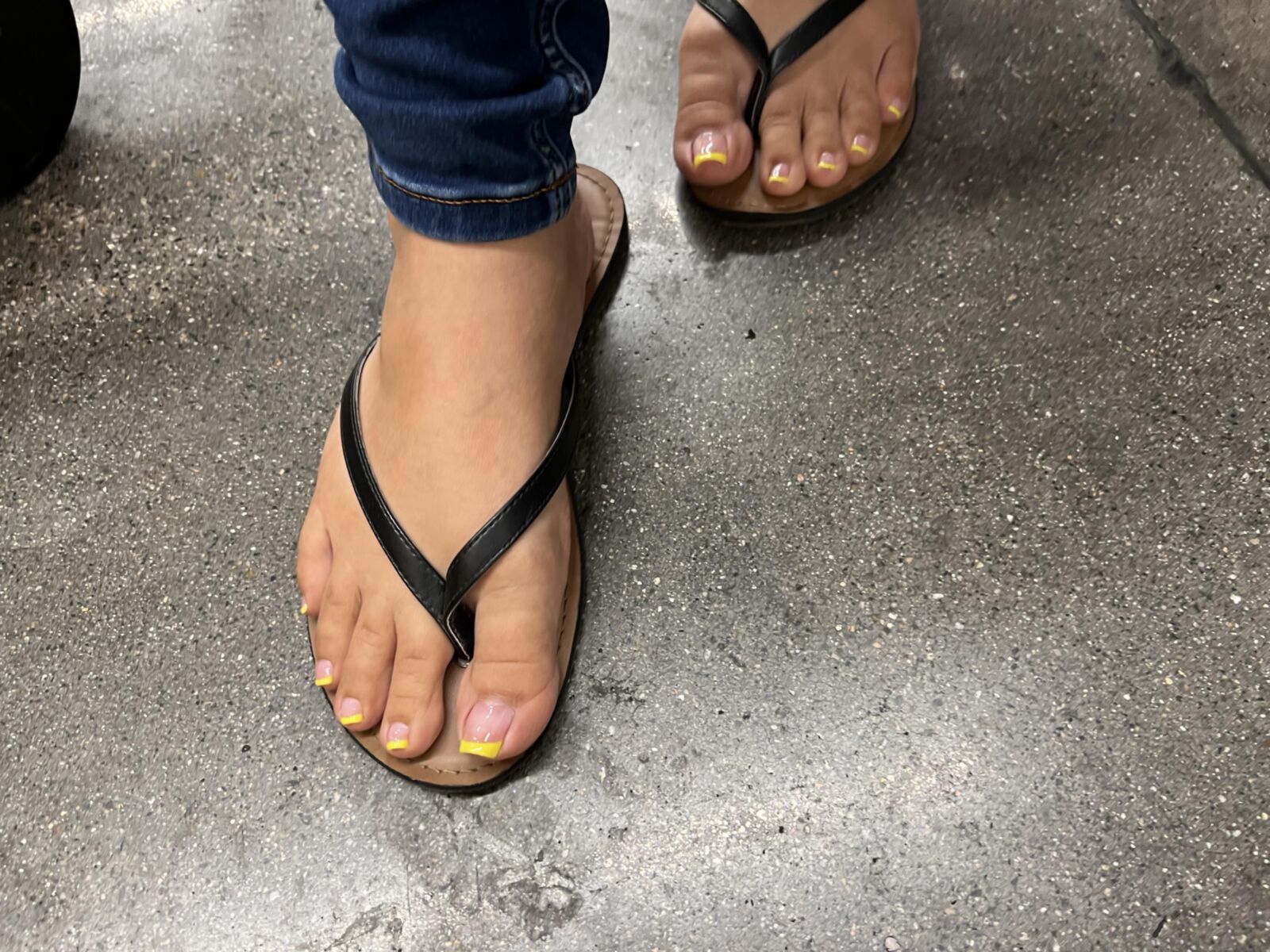 黄色のフレンチチップペディキュア